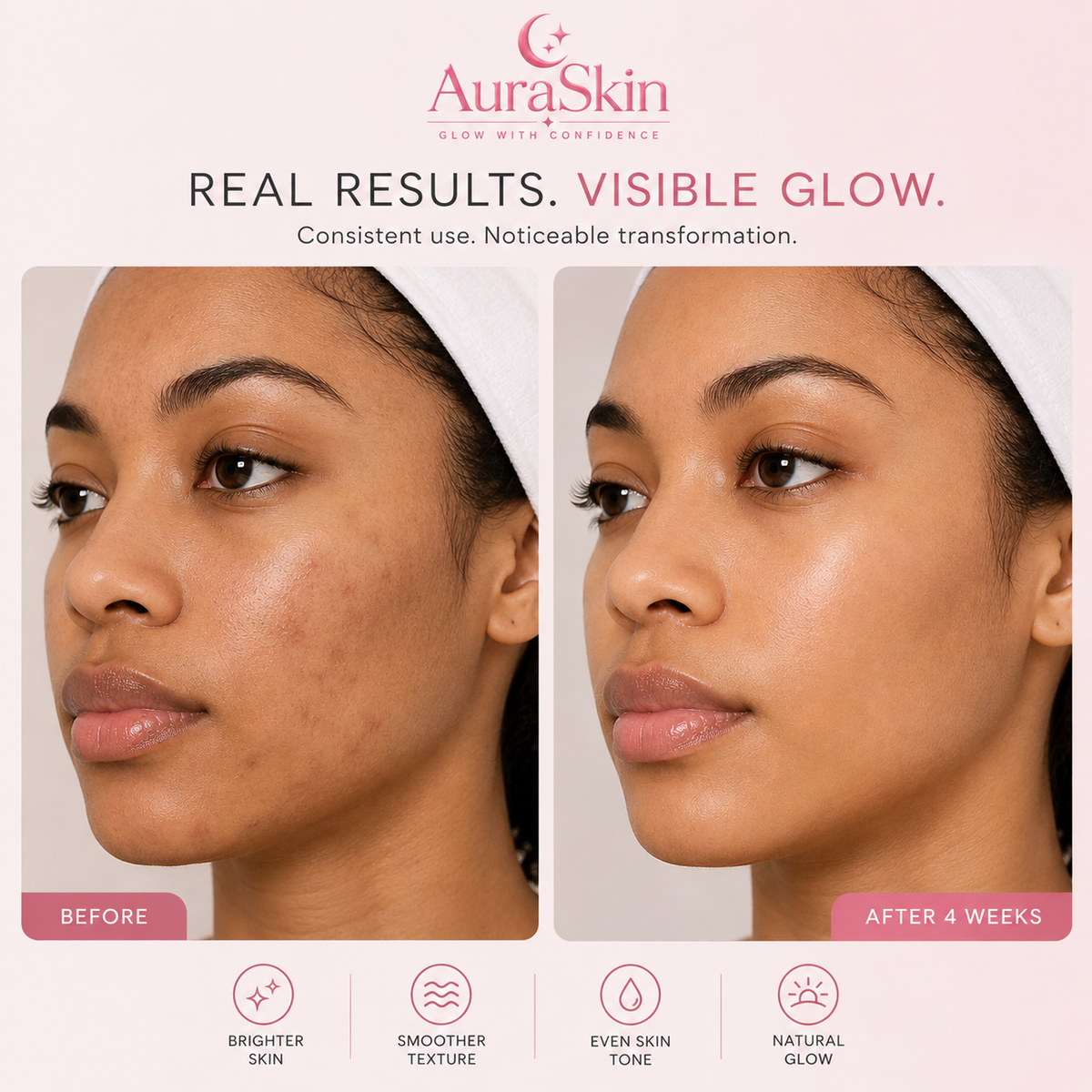 AuraSkin Deep Collagen Overnight Hydrogel Mask™